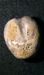 Seeigel, Mattstock